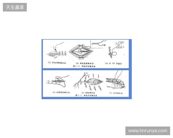 广州豹官方:杨浩眉弓伤口缝合30余针,预计5-7天后拆线 广州豹官方:杨浩眉弓伤口缝合30余针,预计5-7天后拆线